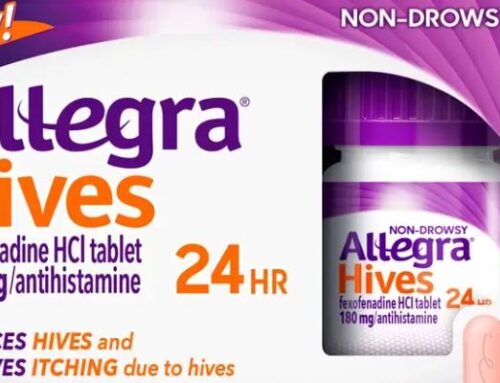 Enjoy Itch-Free Days Try Allegra Hives for Free Allergy Relief